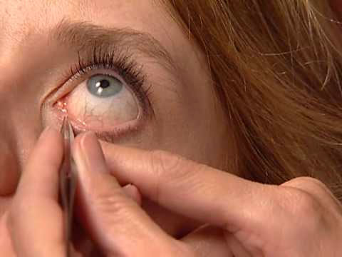 Dry Eye Treatment Eye Doctors in New York, New Jersey, and Connecticut